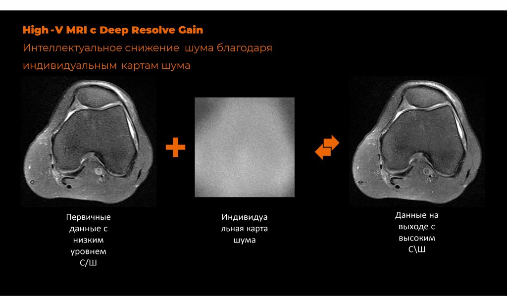 obzor_siemens_magnitom_freemax6.jpg obzor_siemens_magnitom_freemax6.jpg